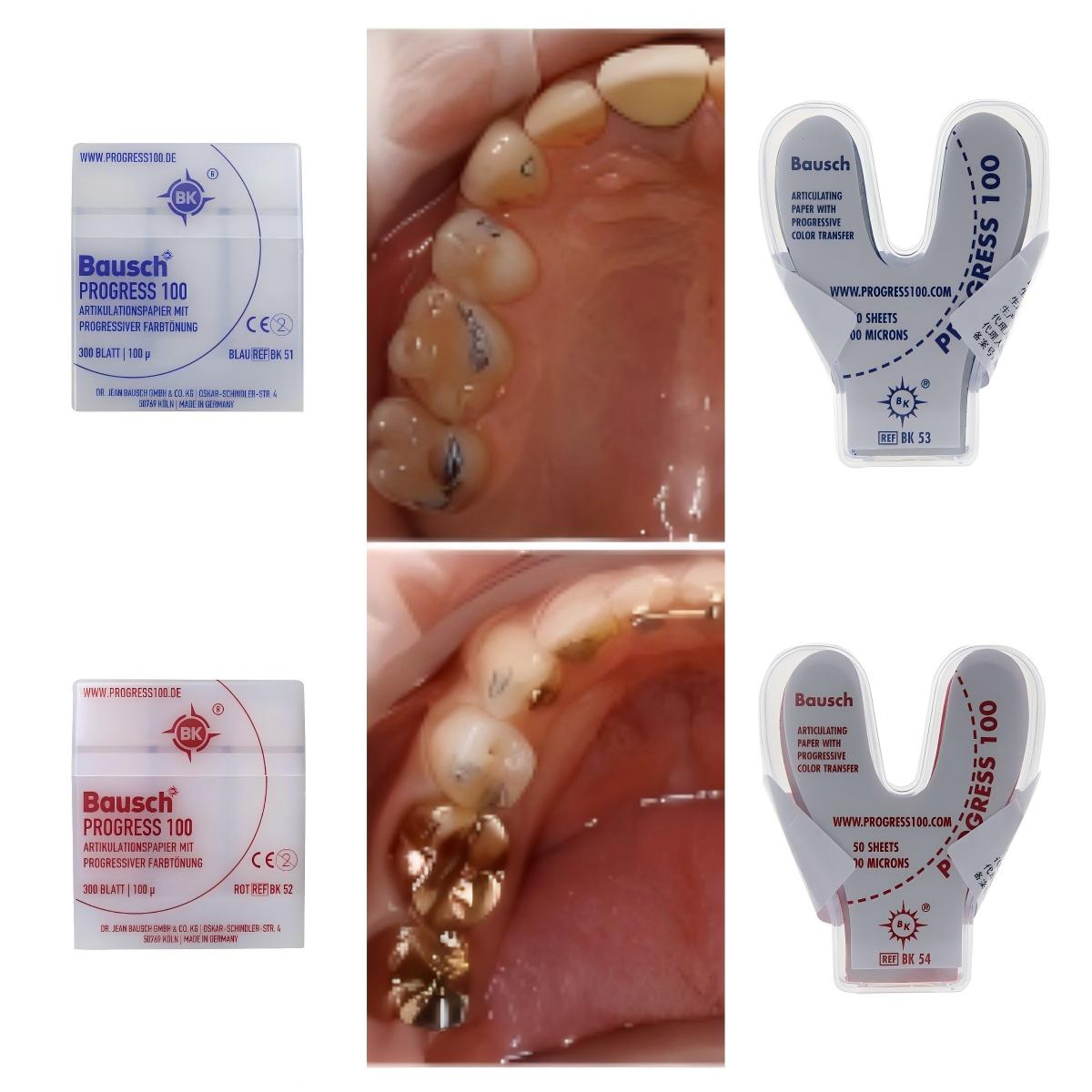 Papel de articulación dental B - Bite Indicator reseña y precio